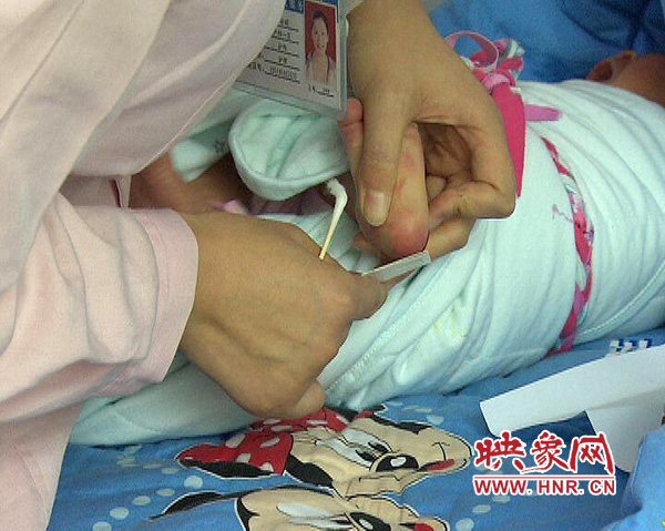醫(yī)護(hù)人員在為一名新出生嬰兒采足跟血，做疾病篩查