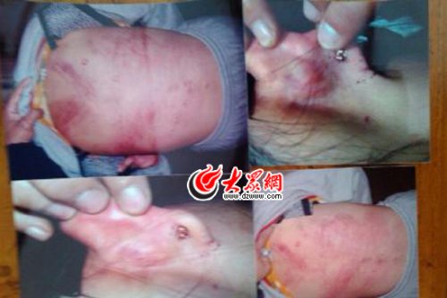 　山東藝術(shù)設(shè)計(jì)學(xué)院16歲女生宿舍內(nèi)被女同學(xué)暴打4小時(shí)。