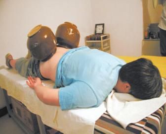 拔泡菜壇子火罐。