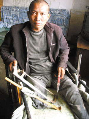 鄭艷良就是用這幾樣簡(jiǎn)陋工具，給自己做了右腿截肢手術(shù)。