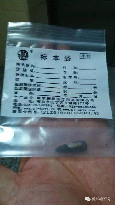 經(jīng)警方鑒定，秦女士體內(nèi)取出的子彈系56式步槍射出 。 受訪者供圖