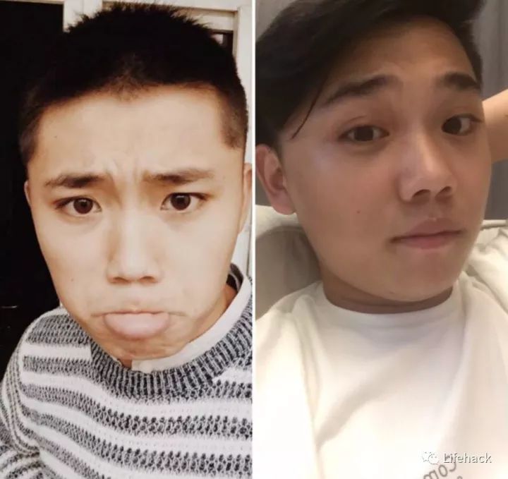 長胖20斤，臉型怎么變？這些例子看完扎心了！