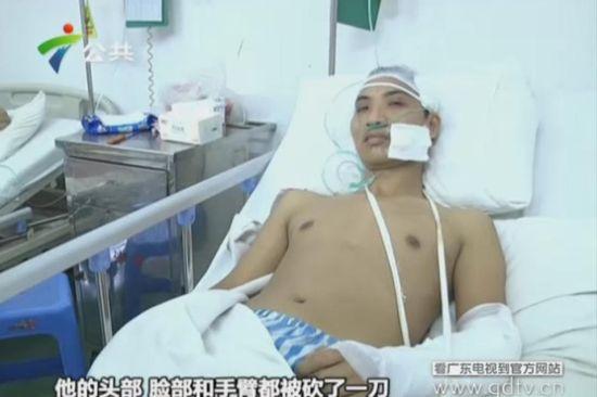 另一名傷者頭部、臉部和手臂都被砍了一刀。(視頻截圖)