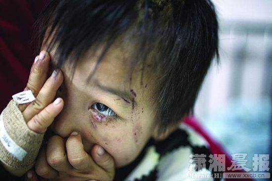 1月13日，湖南省兒童醫(yī)院，4歲的源源用手蒙住了眼睛。