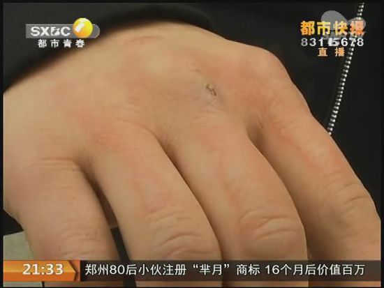 說到這足療拔罐，估計(jì)大伙都不陌生，但是想起4號晚上的拔罐的經(jīng)歷，呂先生現(xiàn)在想起來，還心有余悸。